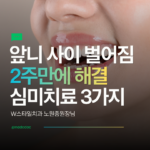 앞니 사이 벌어짐 심미치료 3가지