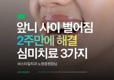 앞니 사이 벌어짐 심미치료 3가지