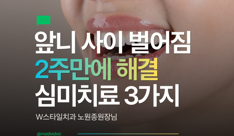 앞니 사이 벌어짐 심미치료 3가지