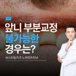 앞니부분교정