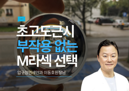 초고도근시를 위한 M라섹 선택
