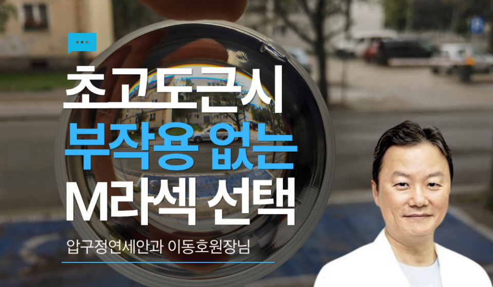 초고도근시를 위한 M라섹 선택