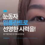 눈동자 임플란트, 아이링수술