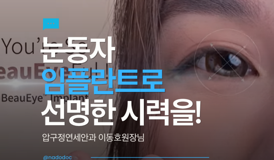 눈동자 임플란트, 아이링수술