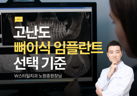 고난도 뼈이식 임플란트 선택 기준