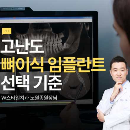고난도 뼈이식 임플란트 선택 기준