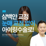 삼백안, 눈매교정없이 아이링수술로 해결