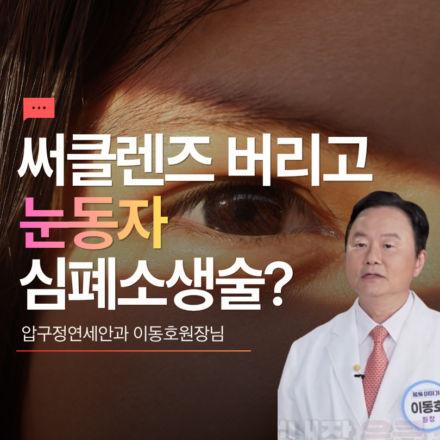 써클렌즈 버리고 눈동자 심폐소생술