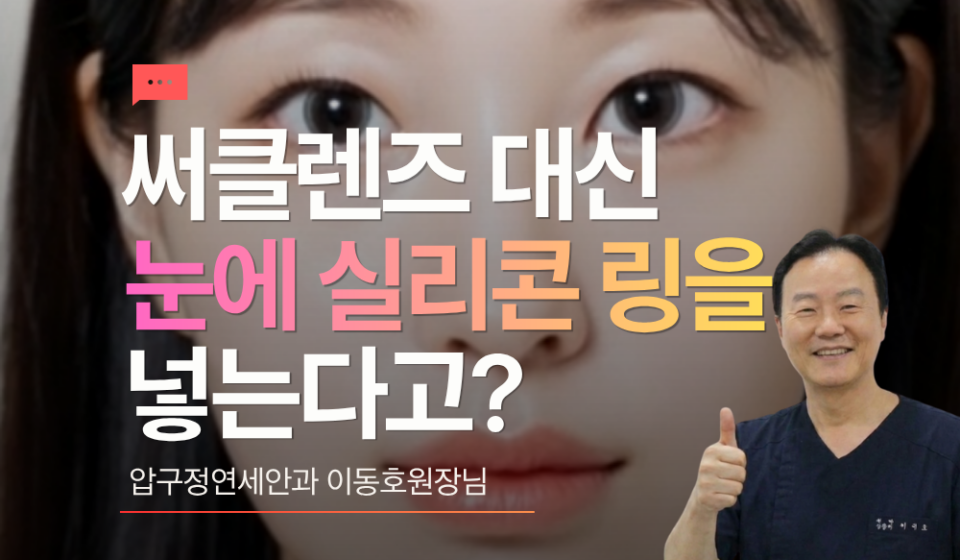 써클렌즈 대신에 실리콘 링 삽입, 아이링수술