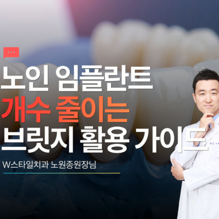 노인 임플란트 개수 줄이는 법과 브릿지