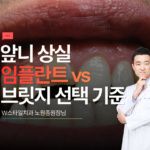 앞니 상실, 임플란트 vs 브릿지 선택 기준