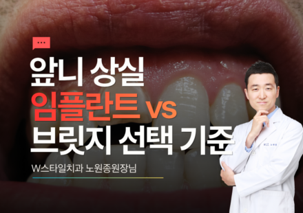 앞니 상실, 임플란트 vs 브릿지 선택 기준