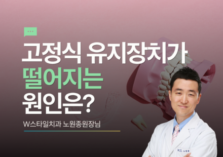고정식 유지장치가 떨어지는 원인
